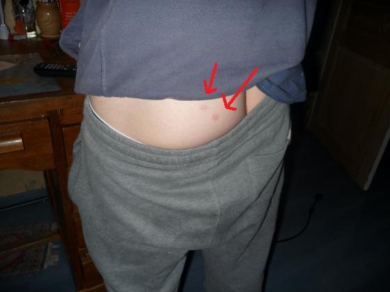 fesse.jpg